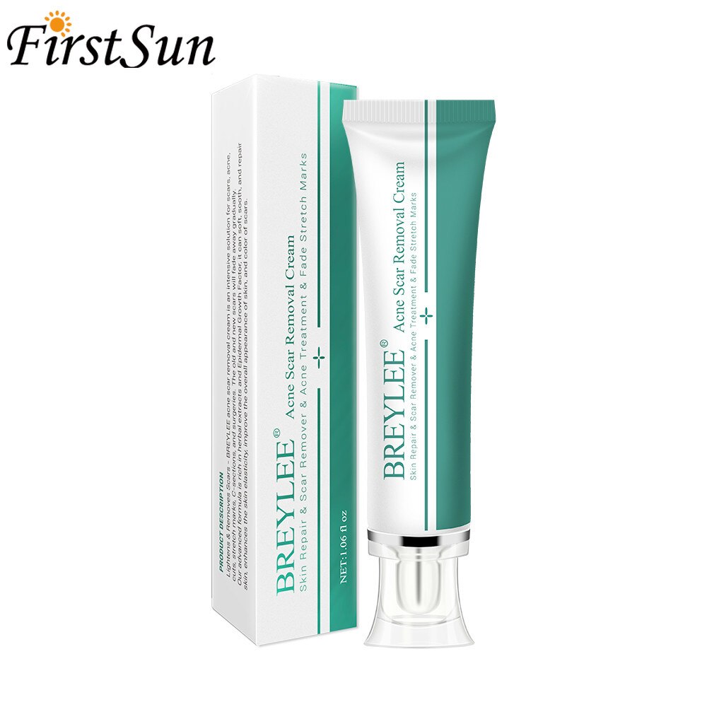 cream for acne marks