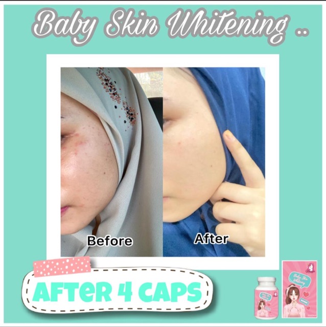 Baby Skin Whitening 100 Ori Shopee Singapore