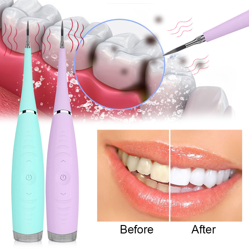 sonic ultrasonic tooth cleaner