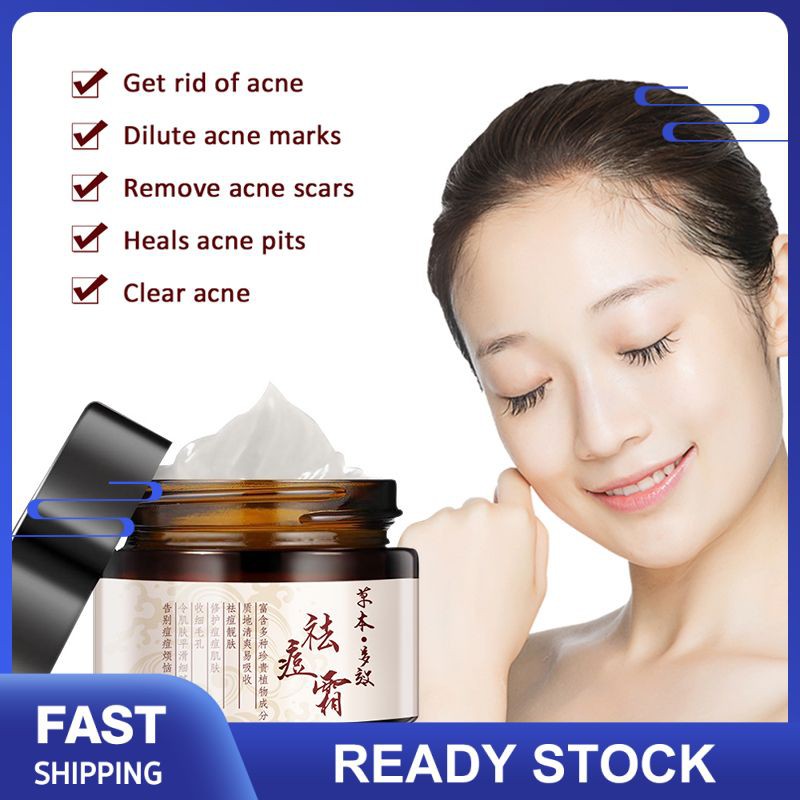 pimple and blackhead remover cream