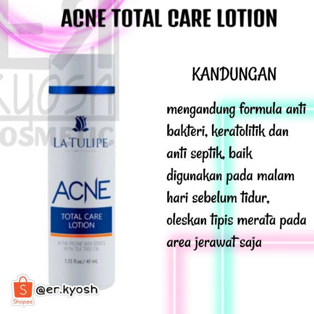 la tulipe acne total care lotion