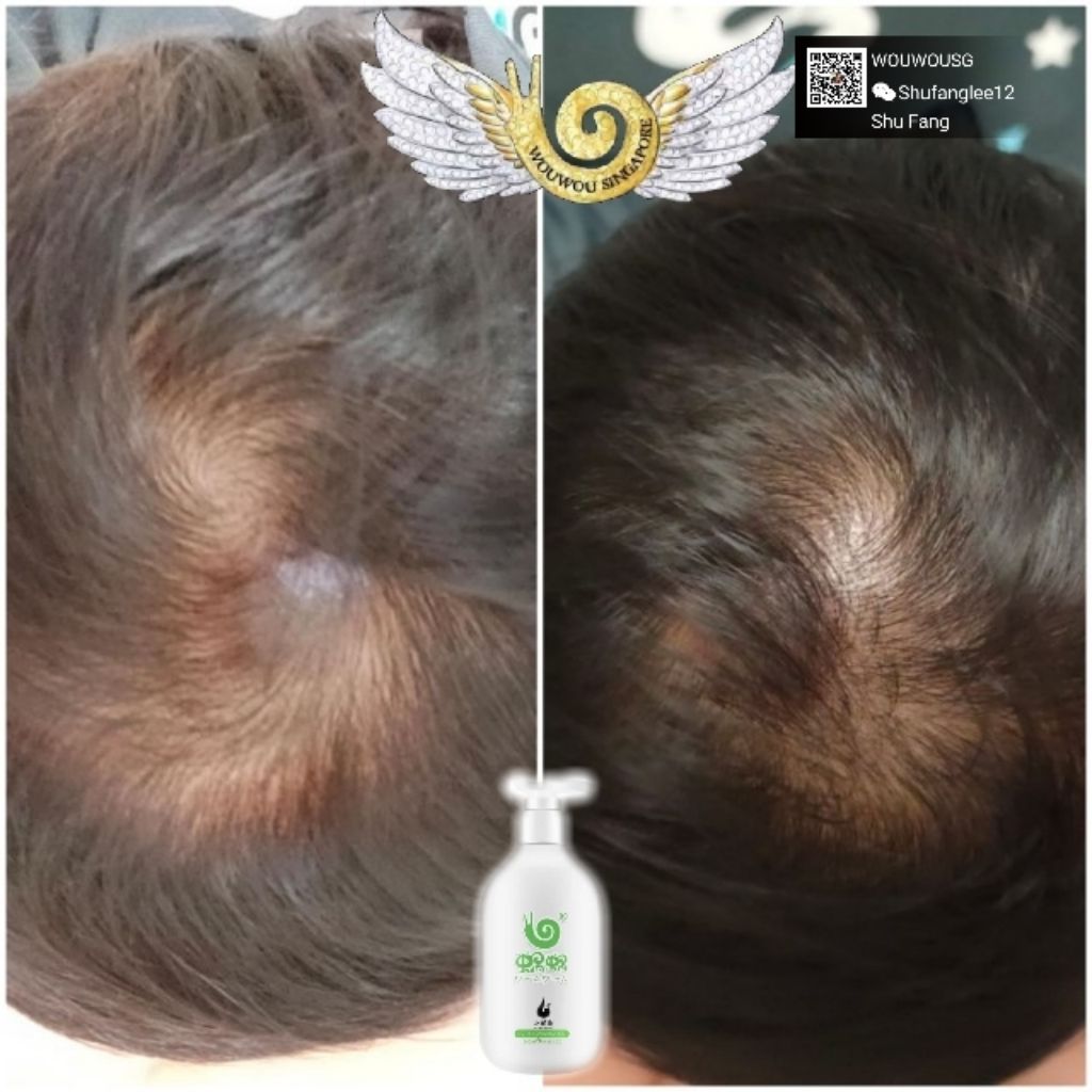 Wouwou Ginger Shampoo Shopee Singapore