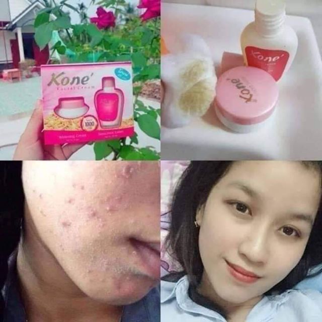 keburukan kone skincare