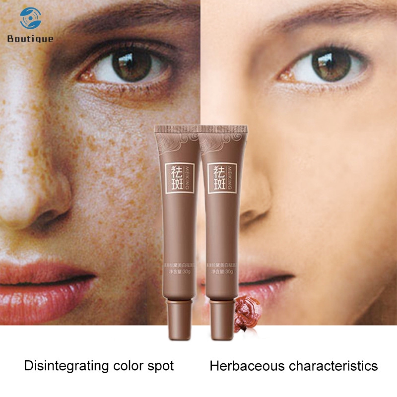 age spot lightening cream