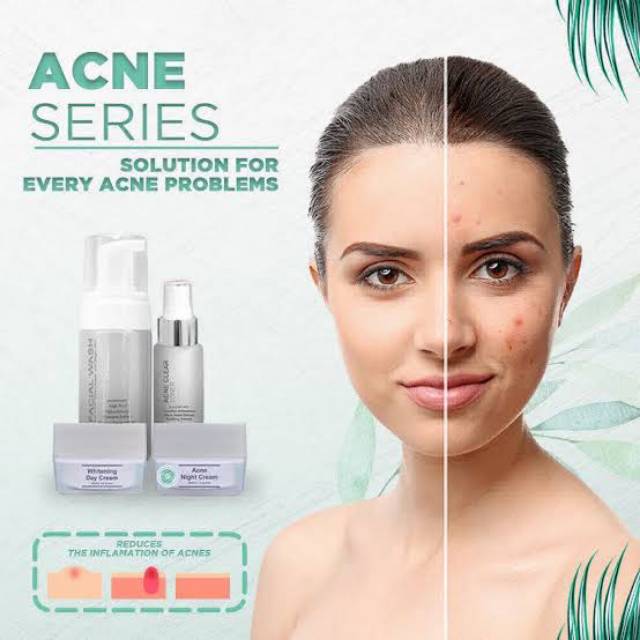 skin care ms glow acne