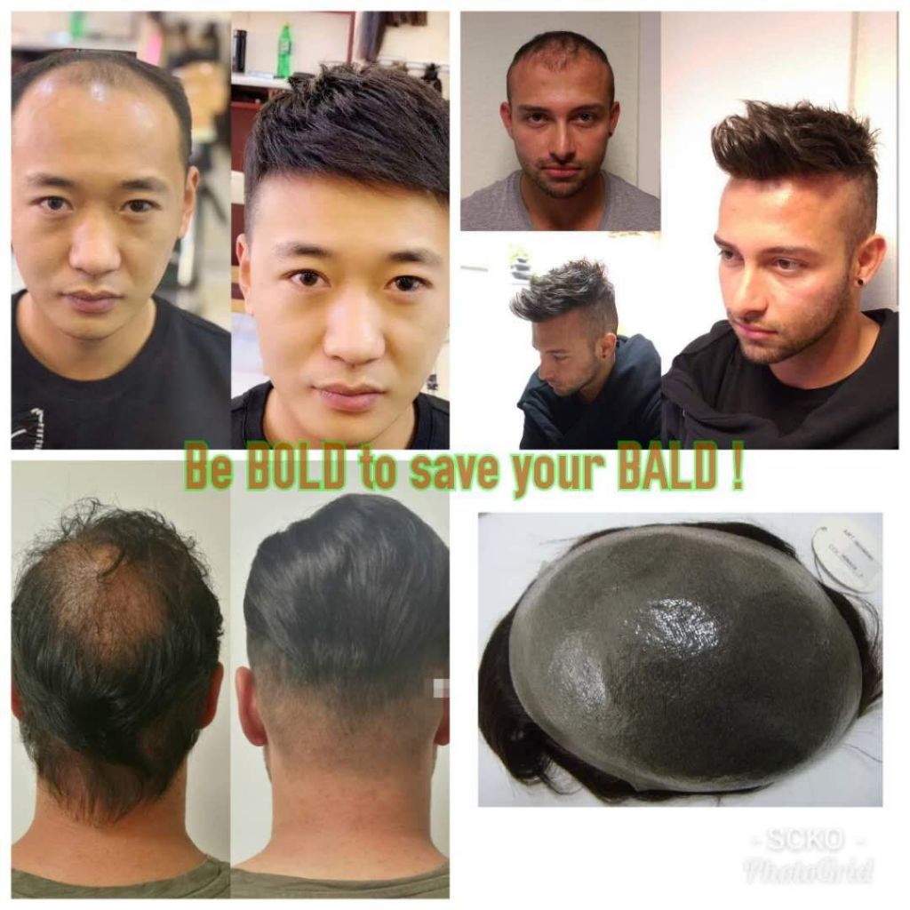Men Non Surgical Hair Replacement Toupee Wig Shopee Singapore
