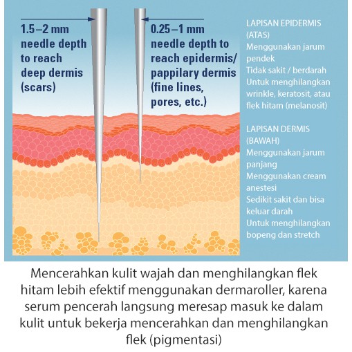 Dermaflek Package To Brightening And Removing Black Fleks Shopee Singapore