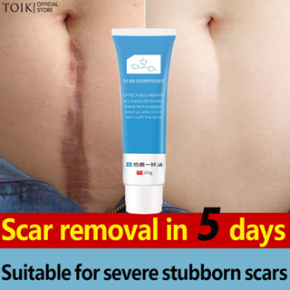Original Scar Remover Acne Scar Removal Cream Stretch Mark Remover Cream Skin Care