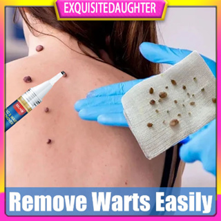 Warts Remover pen for body warts Corn moles Genital warts treatment cream