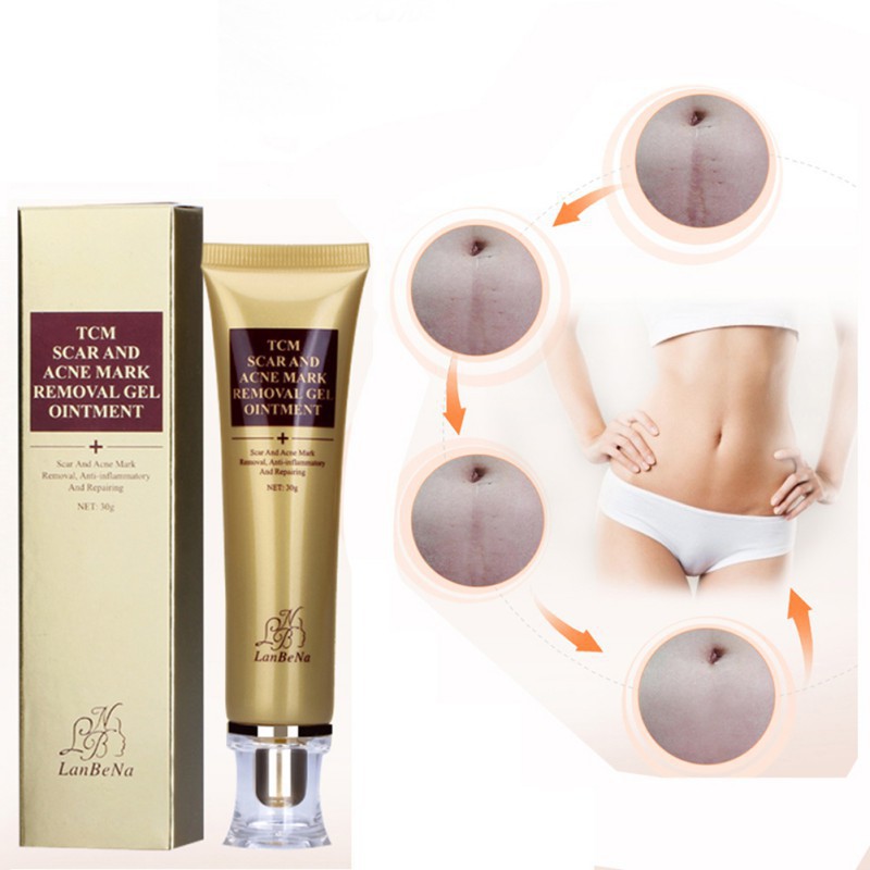 new blackhead removal cream