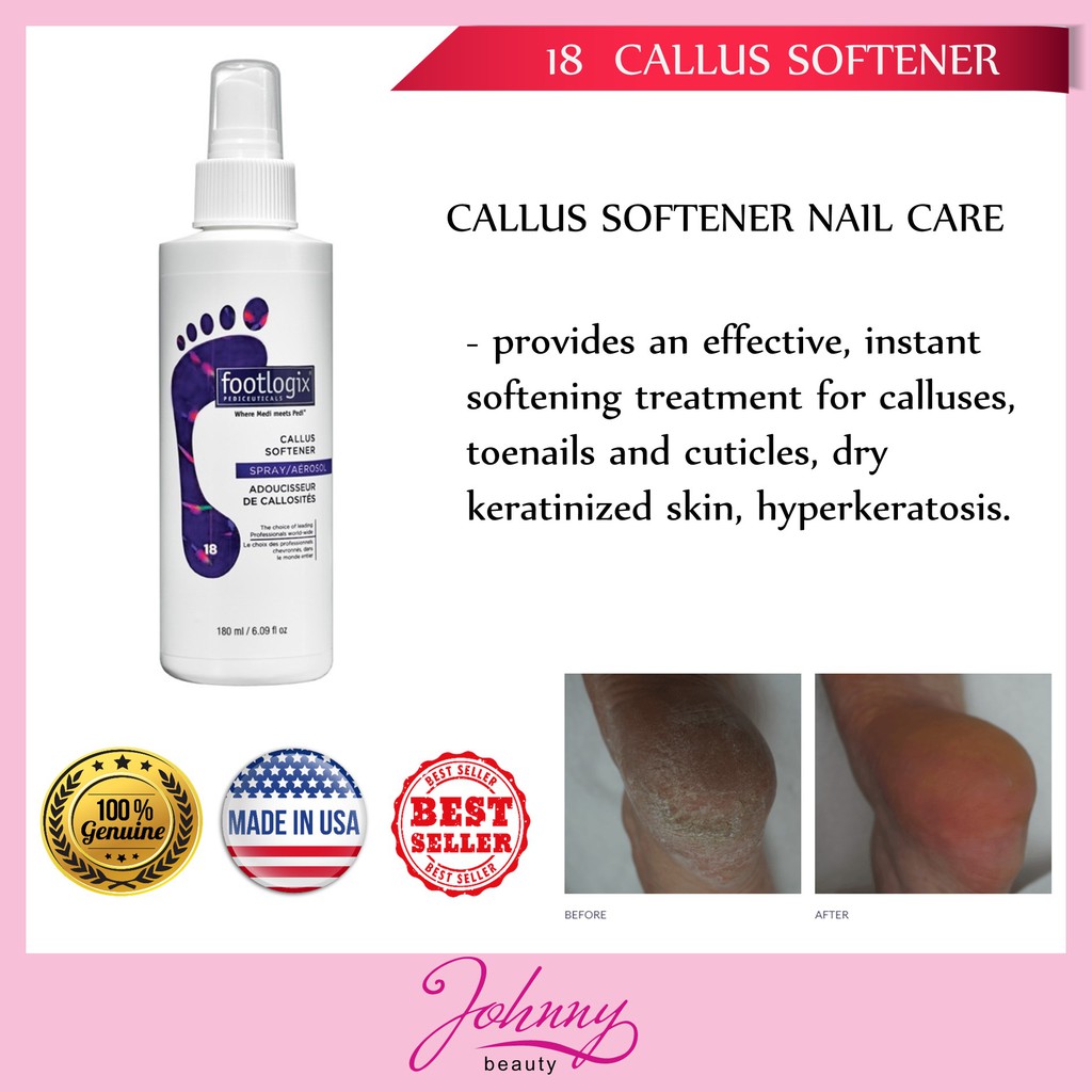 Foot Nail Care - - Footlogix CALLUS SOFTENER | Shopee Singapore