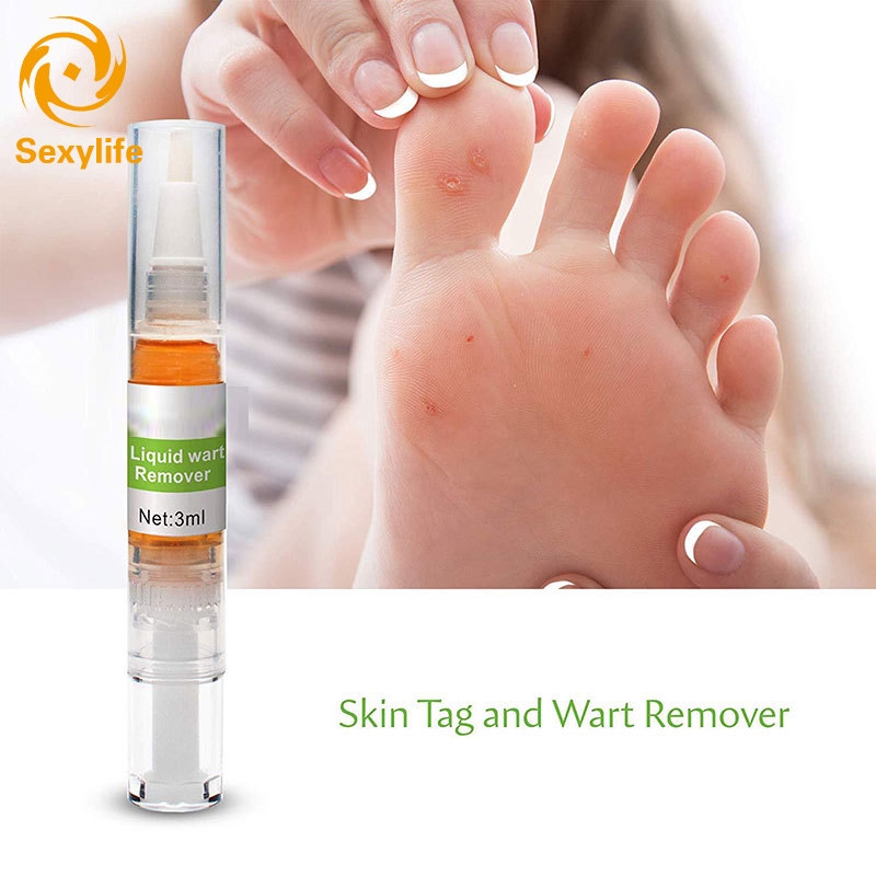 ♛SL Corn Remover Callus Remover Callus Eliminator Callus And Corn