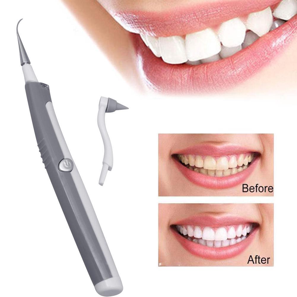 sonic teeth whitening kit