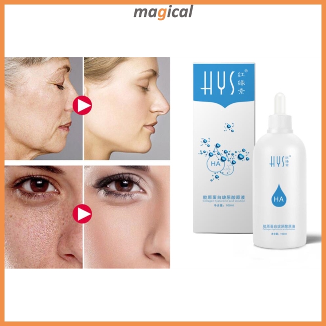 Collagen Hyaluronic Acid Solution Face Essence Anti Wrinkle Hyaluronic Acid Anti Aging Collagen Moisturizing Serum Shopee Singapore