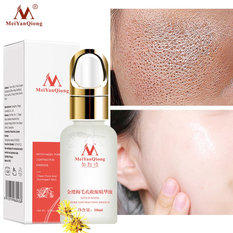 does witch hazel tighten pores