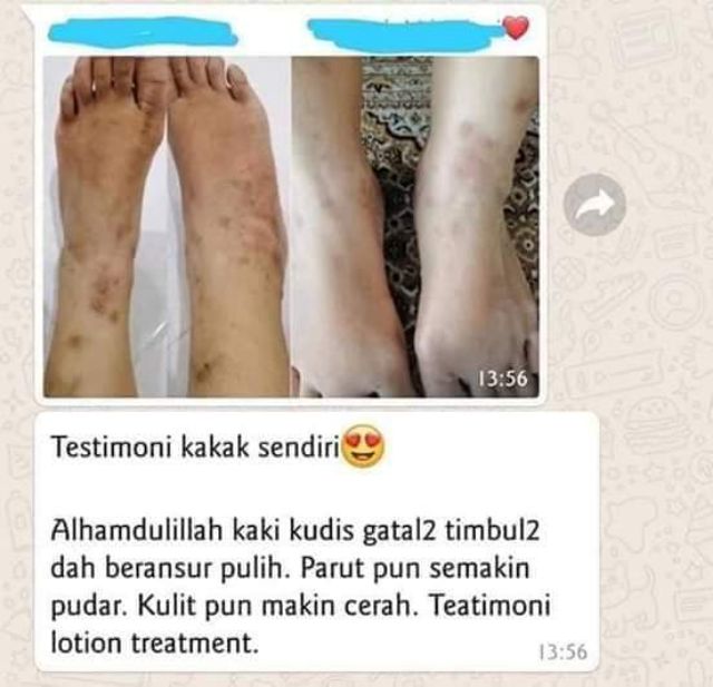 Shop Malaysia Snowy Treatment Lotion Lotion Susu Unta Snowy Treatment Lotion Snowhite Shopee Singapore