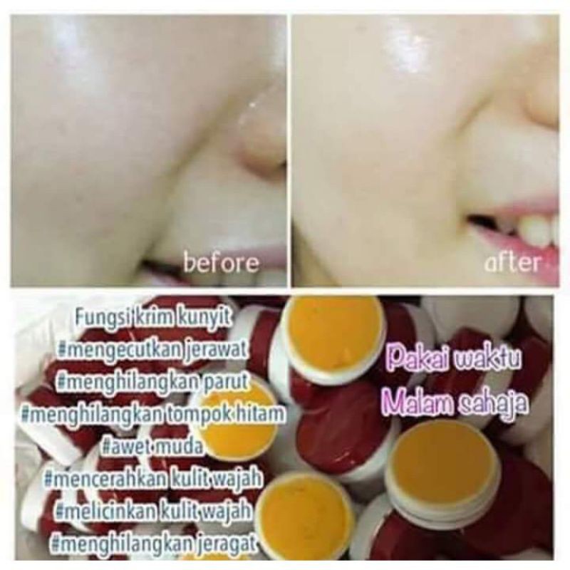 Harga Offer Krim Cream Kunyit Thailand 100 Original Shopee Singapore
