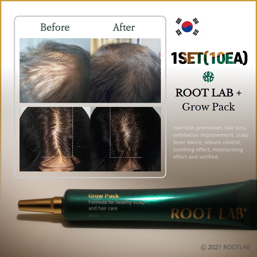ROOT LAB] Grow Pack, hair loss pack 1 set box(10ea)Hair Loss Treatment 4  Ginseng Hair Growth Essence Serum Hair Care for Men and Women | Shopee  Singapore