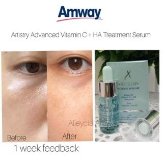 vitamin c serum amway