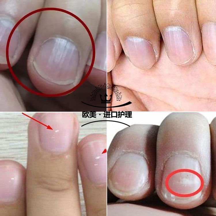 ✾opi protein nail polish nail polish t80 hard nail polish nail nutrient  solution repair nail polish harden nails | Shopee Singapore