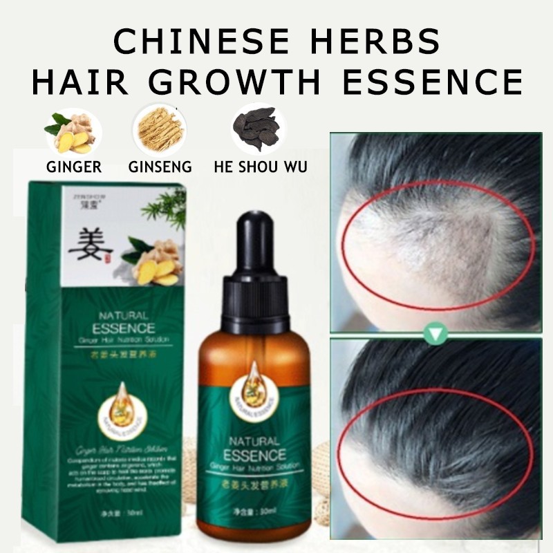 ❤ 1+1+1 ❤ PURE HERBS ❤ HAIR GROWTH ESSENCE ❤ SCALP TREATMENT❤FOR THICKER  HEALTHIER HAIR GROWTH ❤ HAIR LOSS SOLUTION | Shopee Singapore