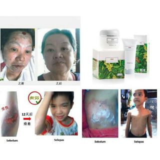 Original Krim Ajaib CNI Nutrimoist 120 gram Skin Care ...