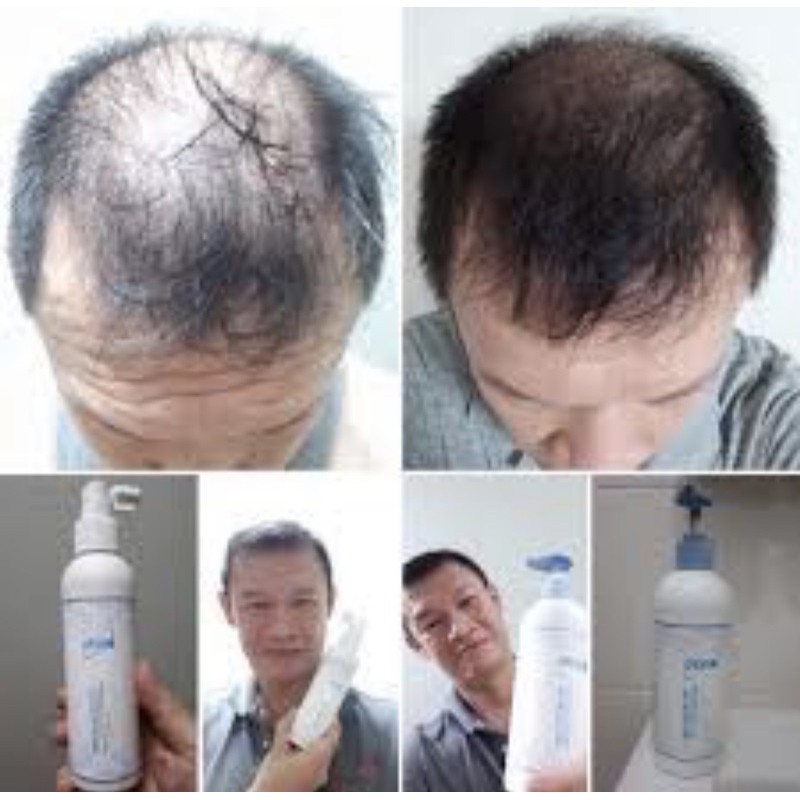 Herbal Hair Loss Shampoo+Hair Growth Tonic From Korea | Shopee Singapore