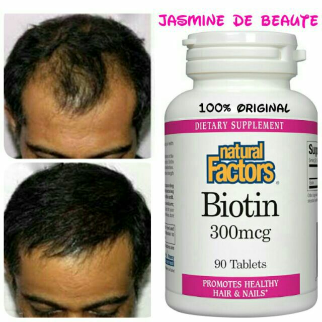 Biotin For Hair Nails Hair Loss Rambut Gugur Botak Hair Growth Shopee Singapore