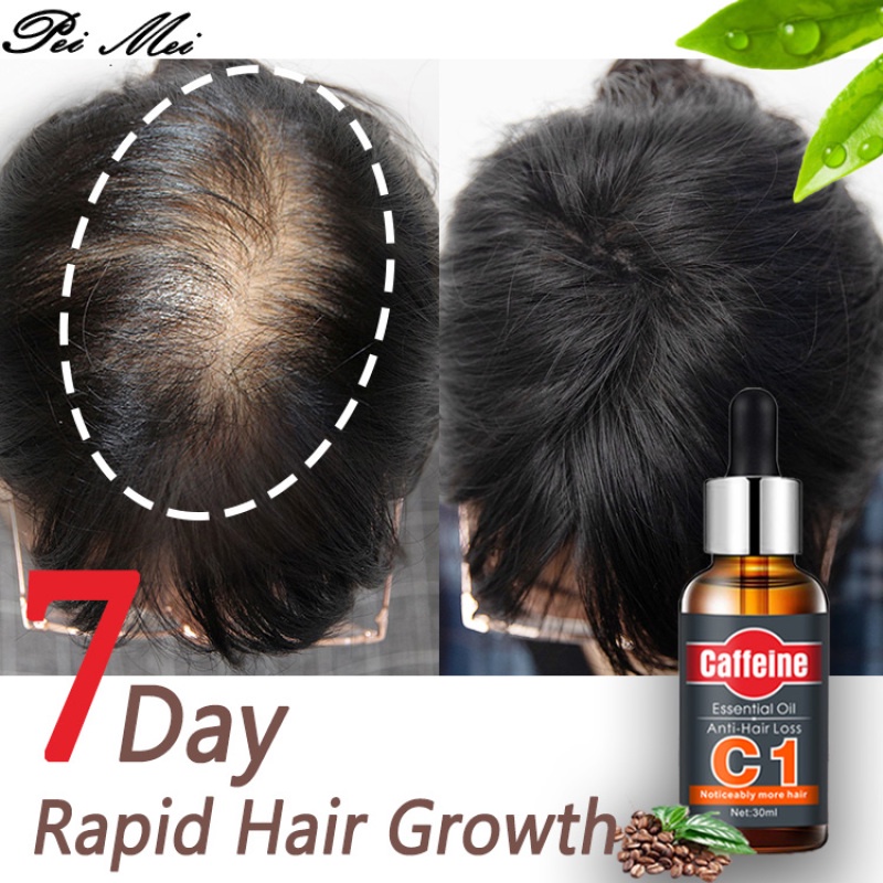 PEIMEI】Caffeine Hair Growth Essential Oil Anti Hair Loss Strengthens Hair  Hair Grower Hair Care Works On Both Men And Women(30ML) | Shopee Singapore
