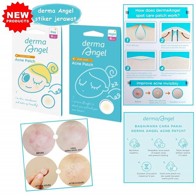 angel pimple patch
