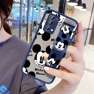 (Cartoon Case) Oppo Reno 5 Pro 5g Reno 5 4G/5G Reno 4 Pro Reno 4 Reno 3 Pro 4g R9s ​Ultra Thin Phone Case Shockproof Mickey Mouse Casing For Girls Soft Edge Case Full Lens Protection Cover (With Wristband)
