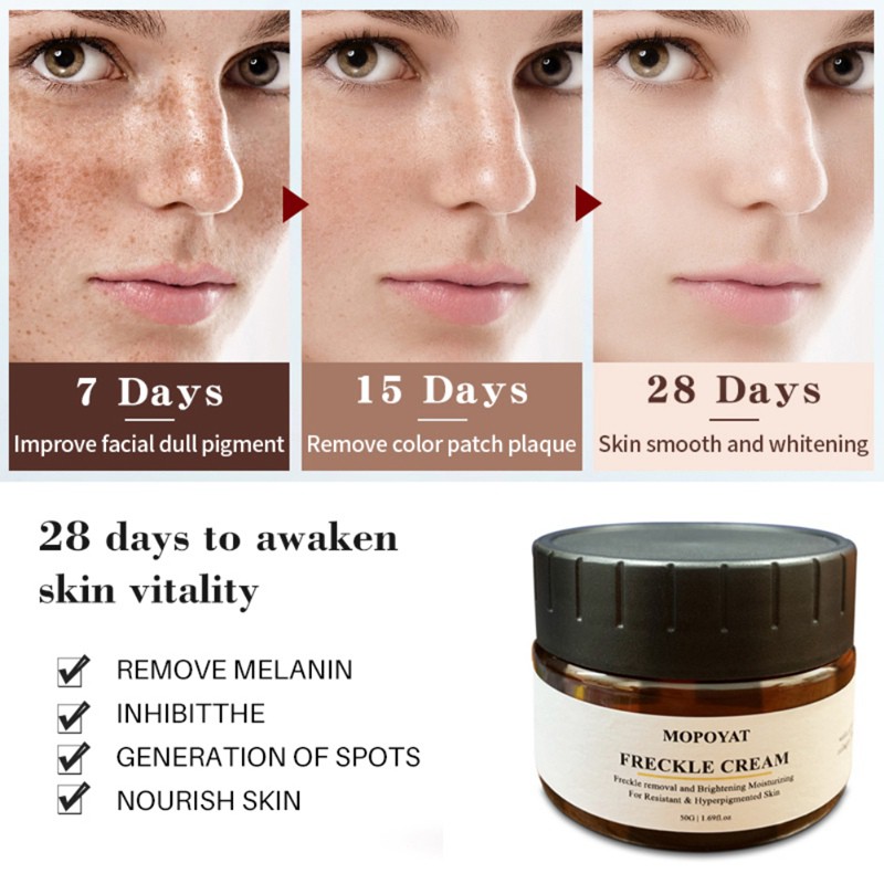 melanin pigment removal cream