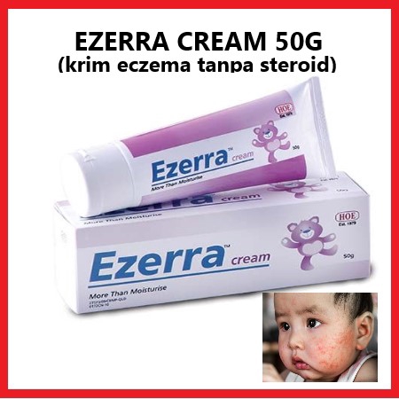 ezerra cream for eczema