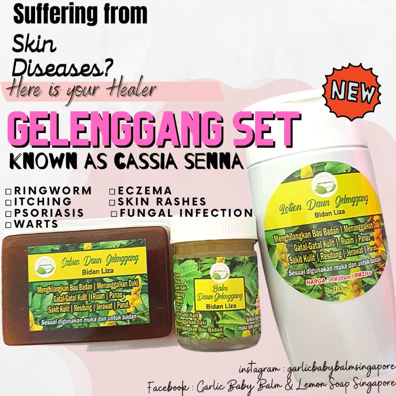 Cassia Senna Gelenggang Balm Soap Lotion By Bidan Liza For Ringworn Panau Skin Infection Shopee Singapore