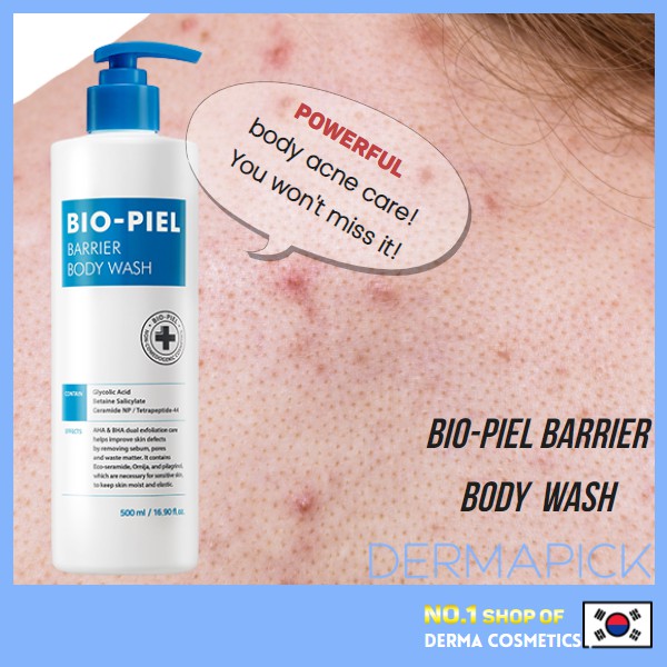 eczema acne prone skin