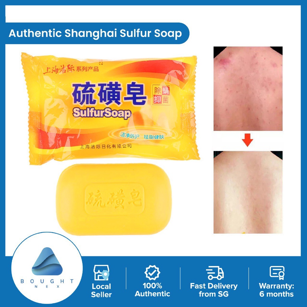 Shanghai Sulfur Healthy Soap Bar Anti Itching High Efficiency Acne Treatment For Skin Care