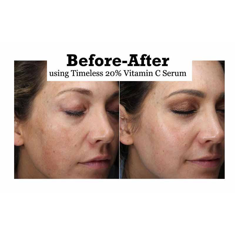 timeless ce serum