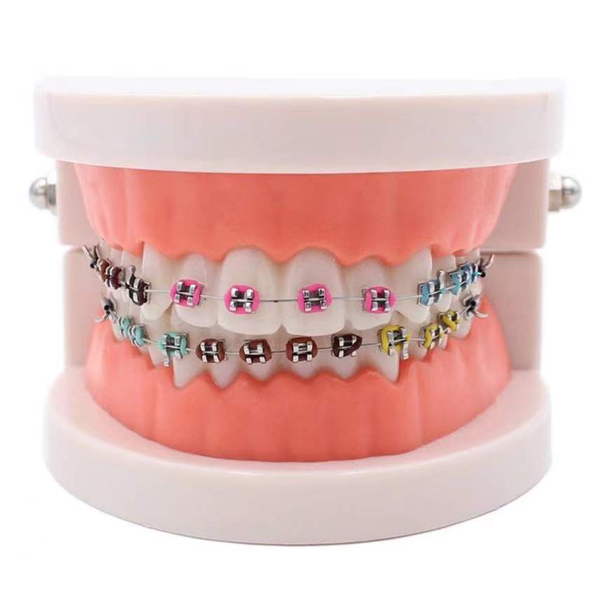 Dental Teach Study Orthodontic Tooth Teeth Model with Metal Brackets