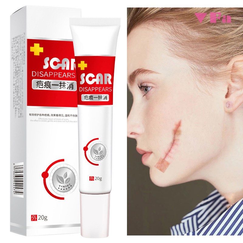 red spots removal cream