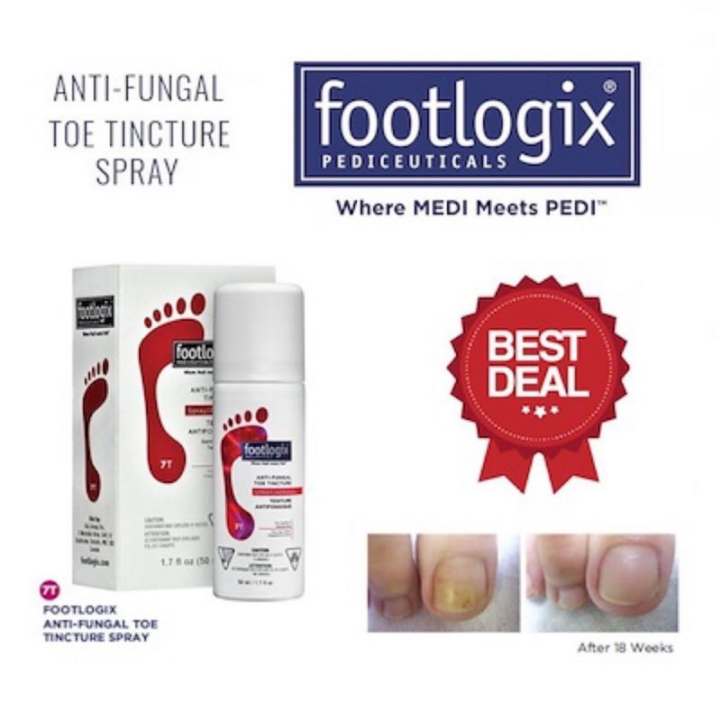 Footlogix Anti fungal toe tincture spray _ Authentic 100 from USA