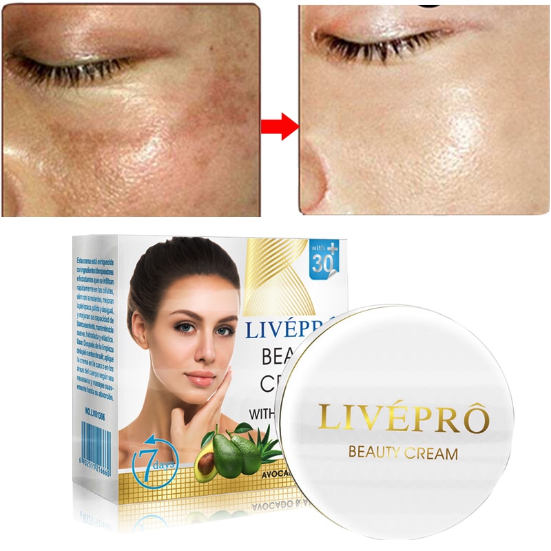 dark skin lightening cream