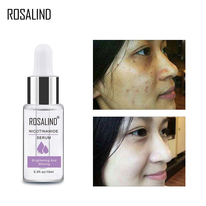 rosalind deep cleanser