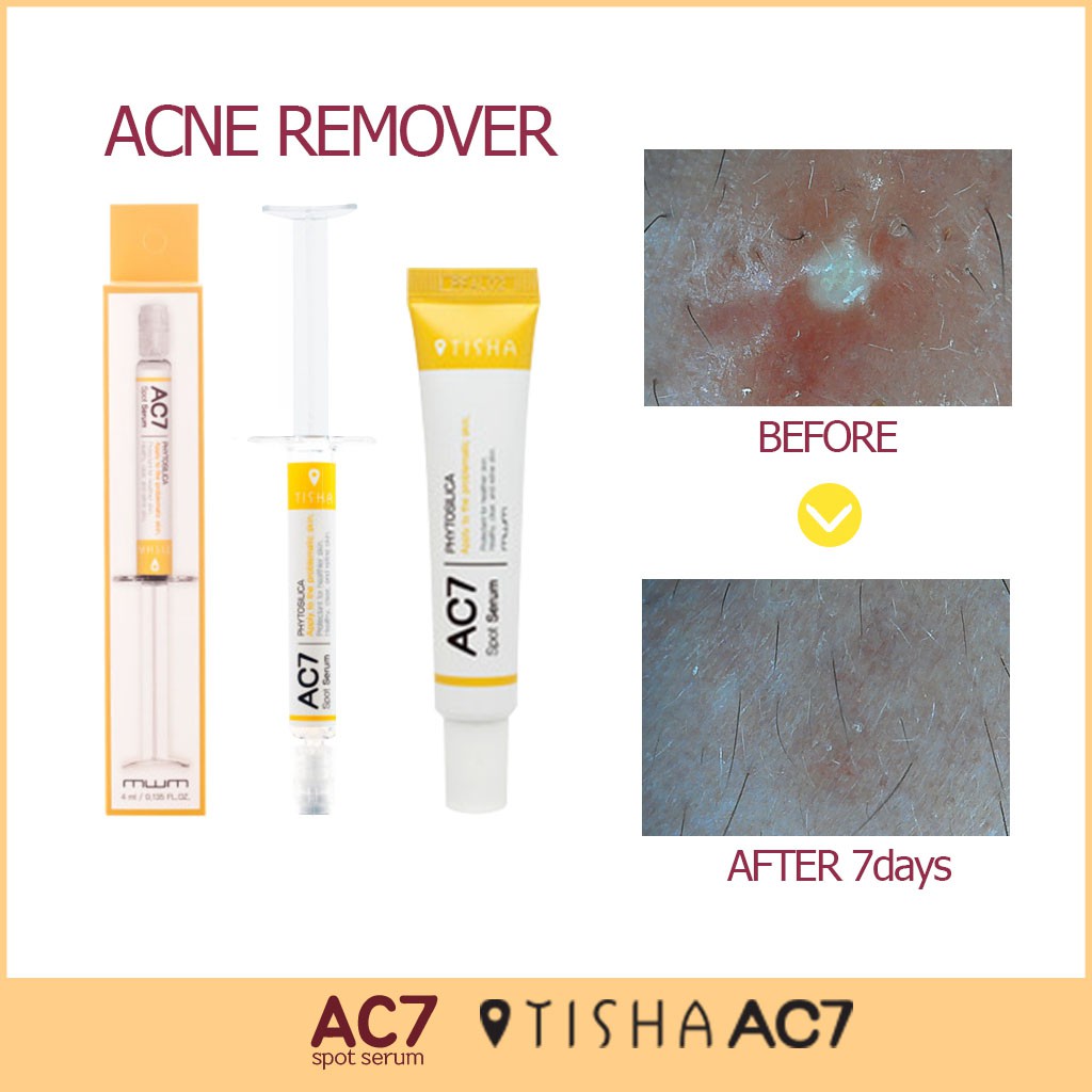 Acne Remover Tisha Ac7 Spot Serum Shopee Singapore