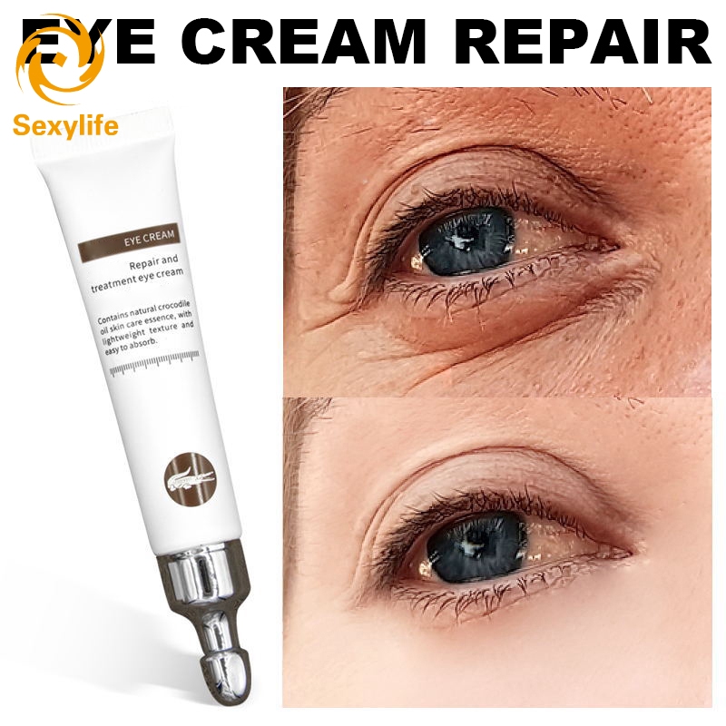 eye serum for eye bags