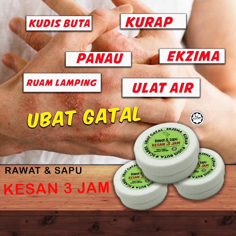 Itching Medicine Kudis Kurap Panau Water Eat Itching Slit Shopee Singapore