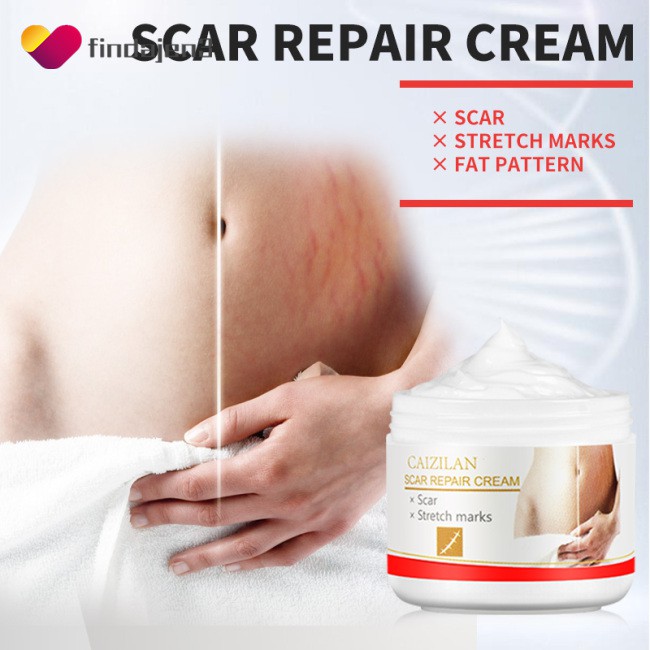 body stretch marks removal cream