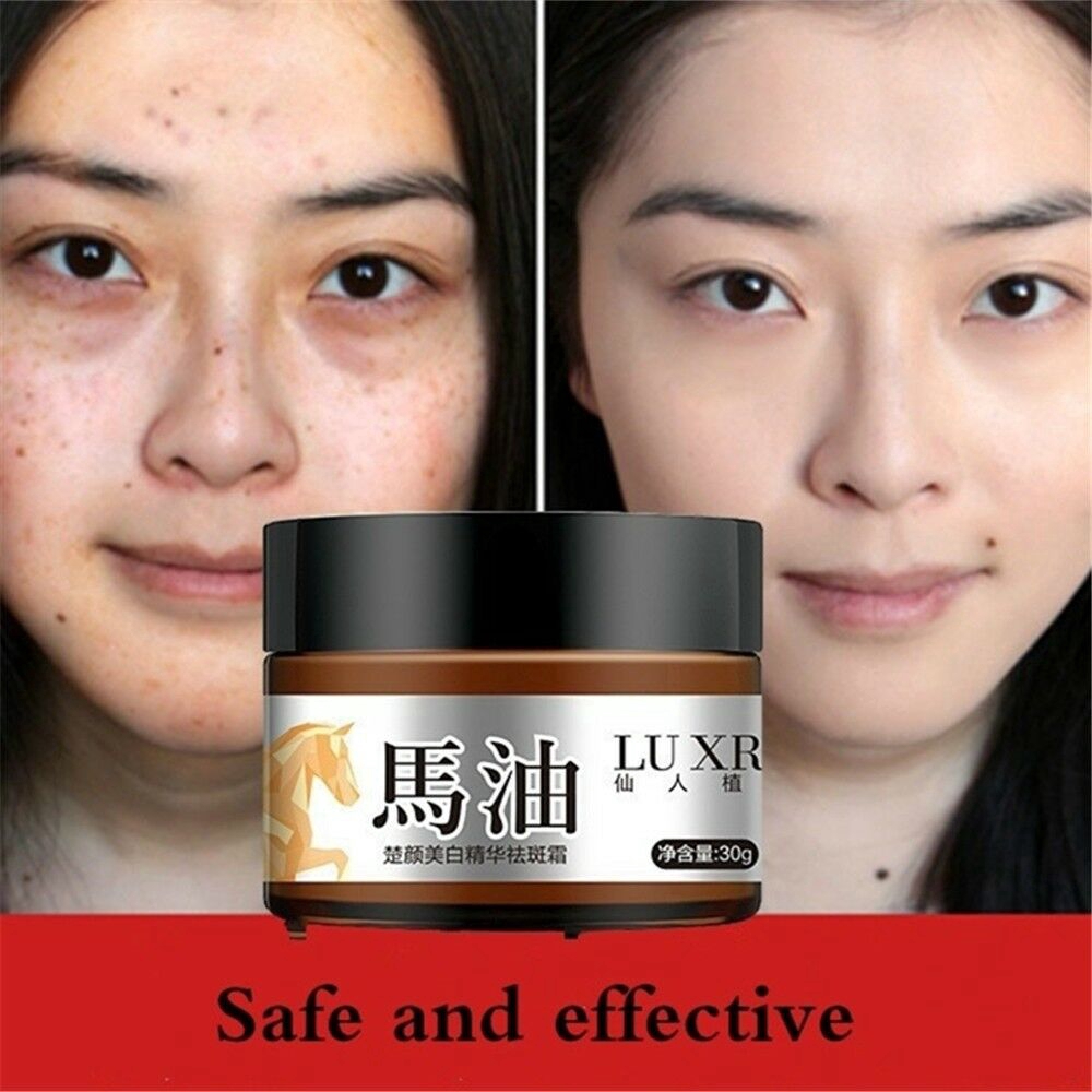 age spot & skin brightening cream