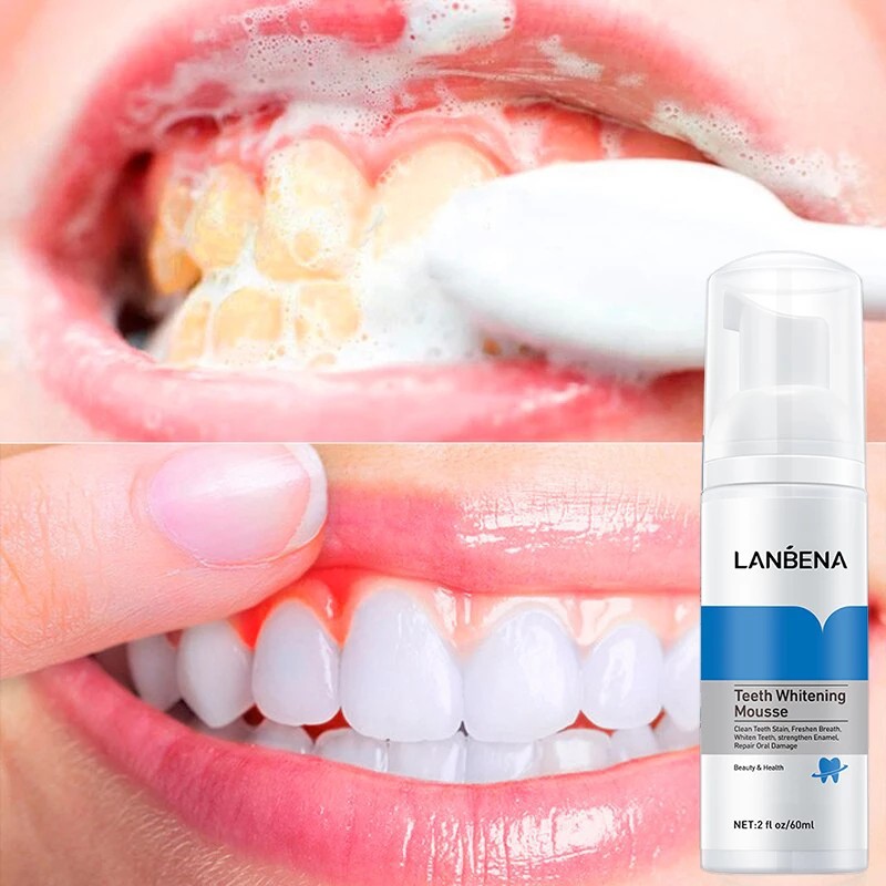 LANBENA Teeth Whitening Mousse 60ml f7a50854187204b7d73598ad3e50f558