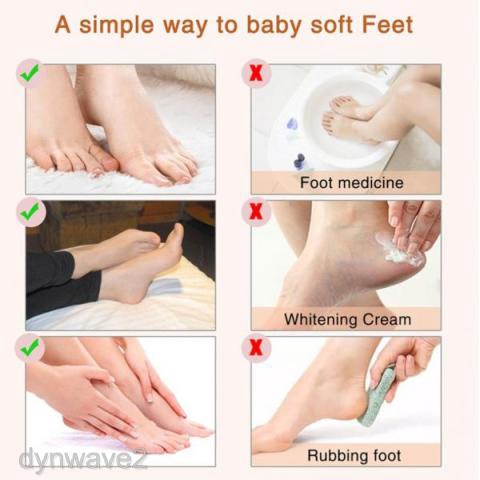 foot peel for men