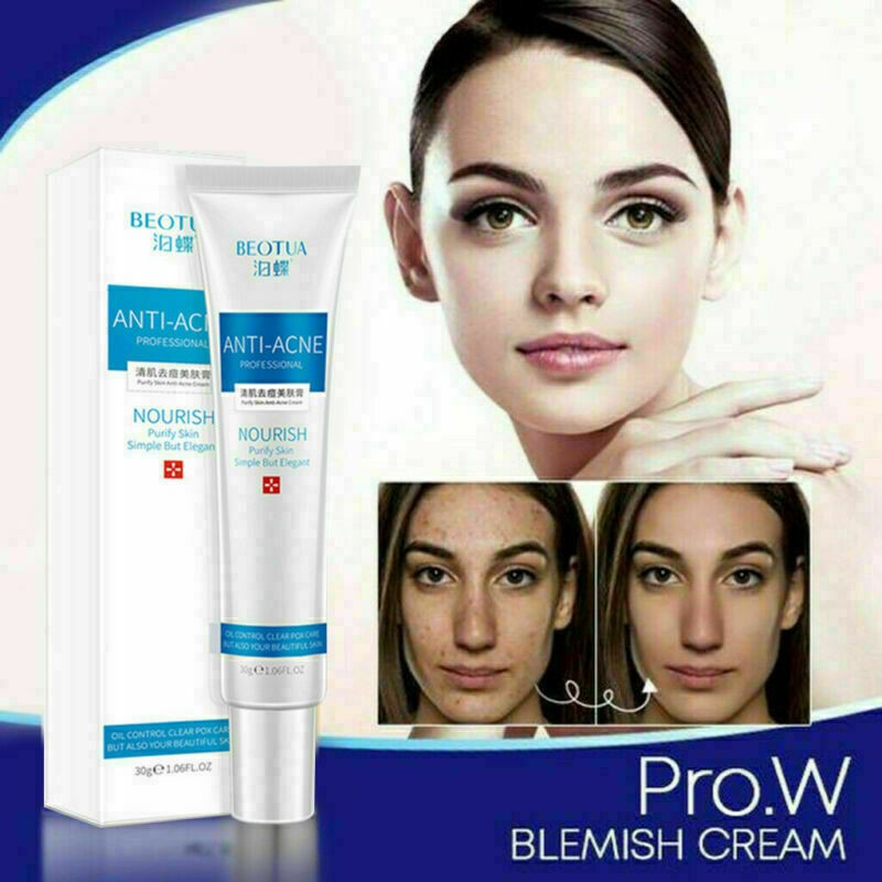 blemishes cream treatment